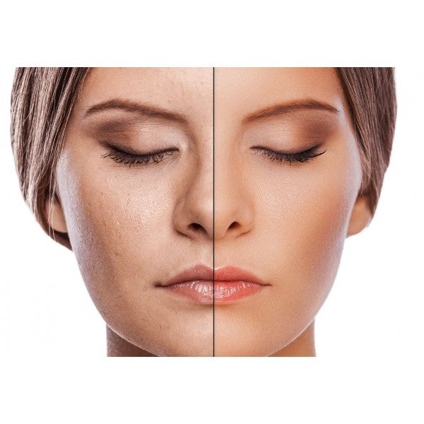 Rigenera Crema facial regeneradora antienvejecimiento con ácido hialurónico, colágeno, oro coloidal y manteca de karité.